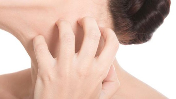 Đối với làn da mỏng, nhạy cảm cần cẩn trọng khi sử dụng chanh